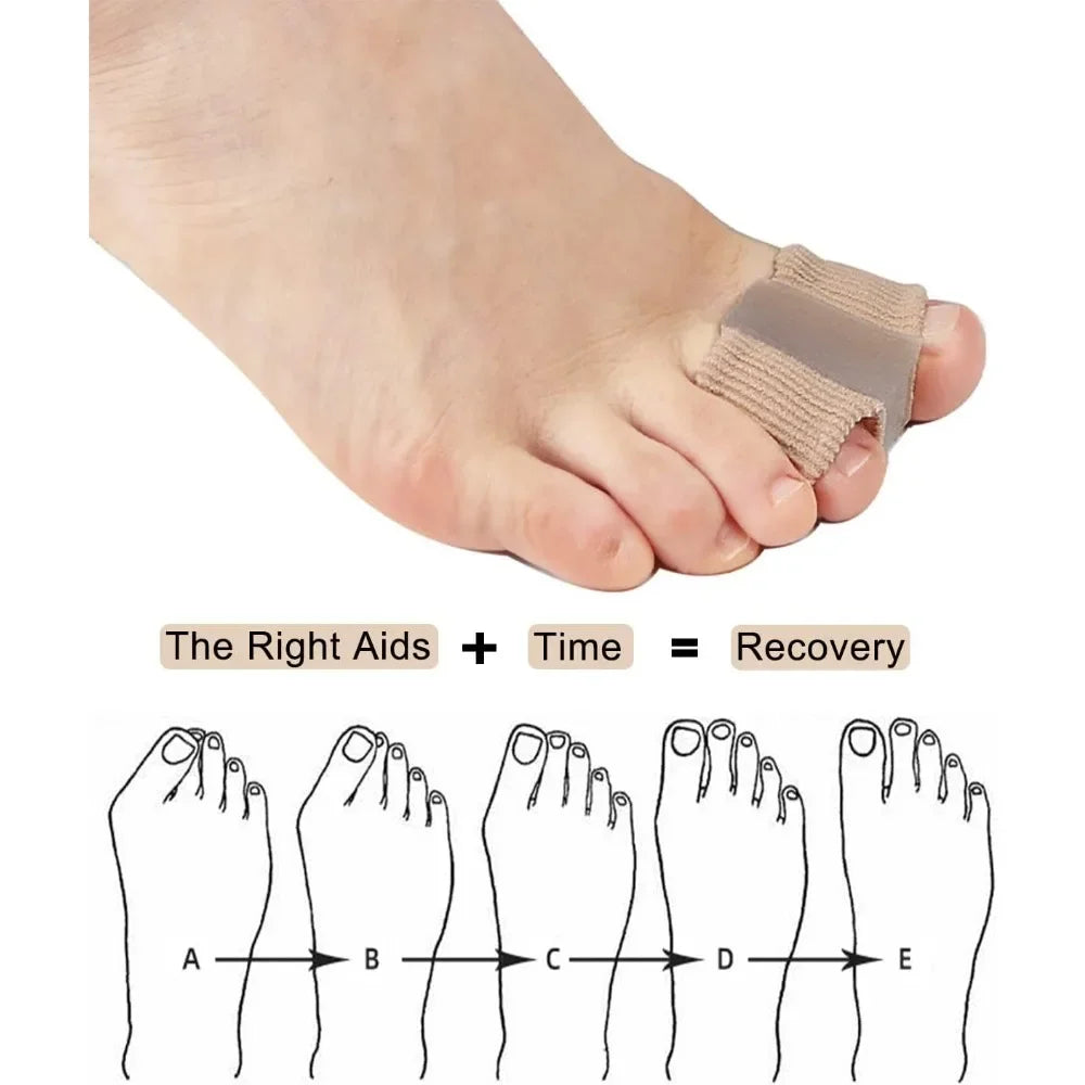 Bunion Corrector Toe Separator